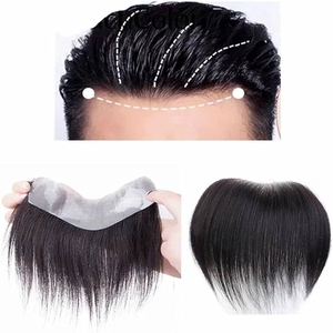 TUW20 Hair Patch for Women: A Revolutionary Solution for Thinning Hair | Confidence and Style Restored